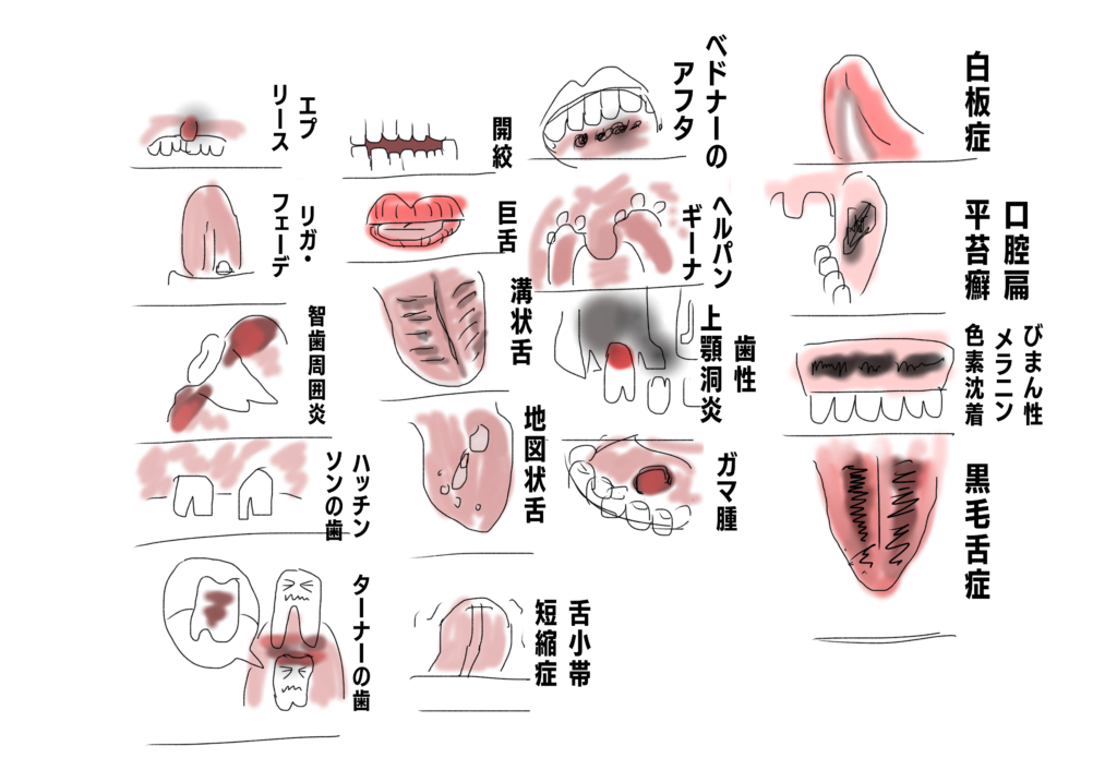 臨床歯科医学・口腔外科学のイラスト | 村鉄堂のHP